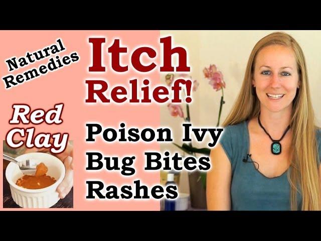 Home Remedy To Get Rid Of Poison Ivy